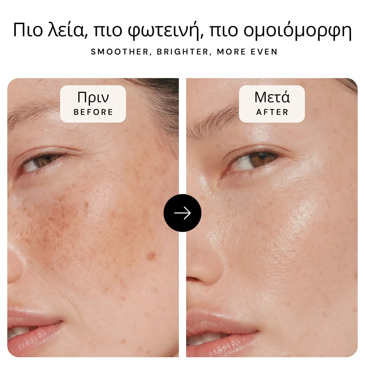 Πρωτόκολλο Αναδόμησης Φθινοπώρου-Χειμώνα