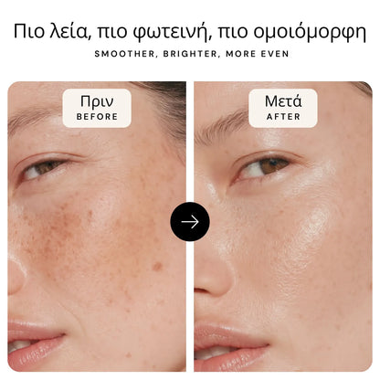 Πρωτόκολλο Αναδόμησης Φθινοπώρου-Χειμώνα